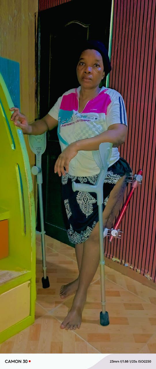 Aidons Maman Gouzouo Clarisse à marcher à nouveau et retrouver son sourire ❤️ - Image 3