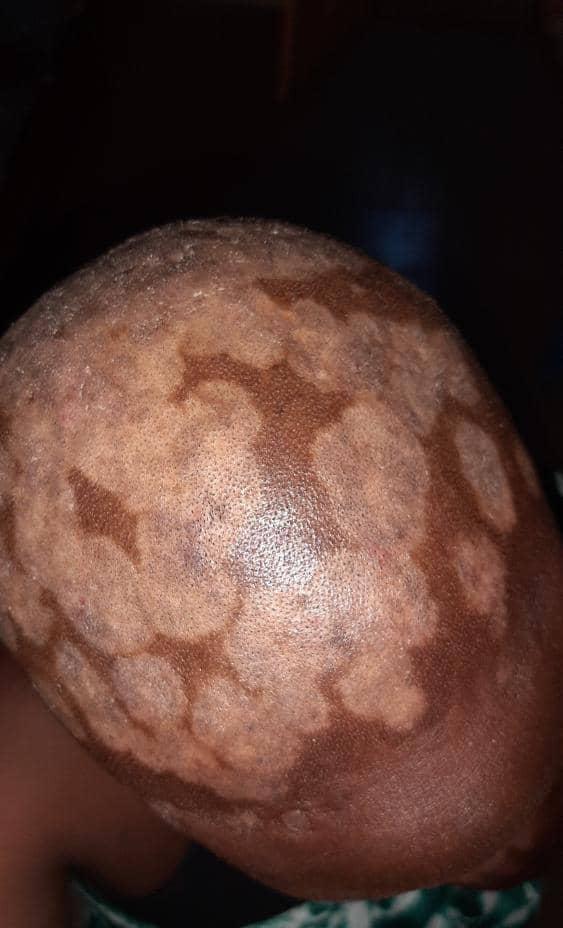 Aide pour les frais medicaux