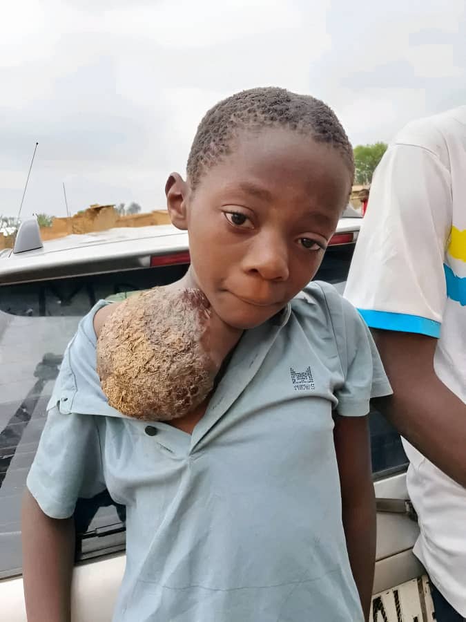 Urgence médicale pour Gloire — Aidons cet enfant orphelin à se soigner