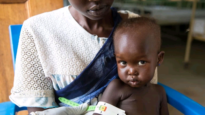 Lutte contre la malnutrition aiguë seveur chez les enfants en RD Congo. Promotion de droit de femmes