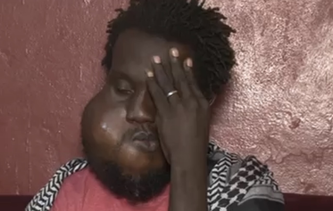 Aide pour frais médicaux