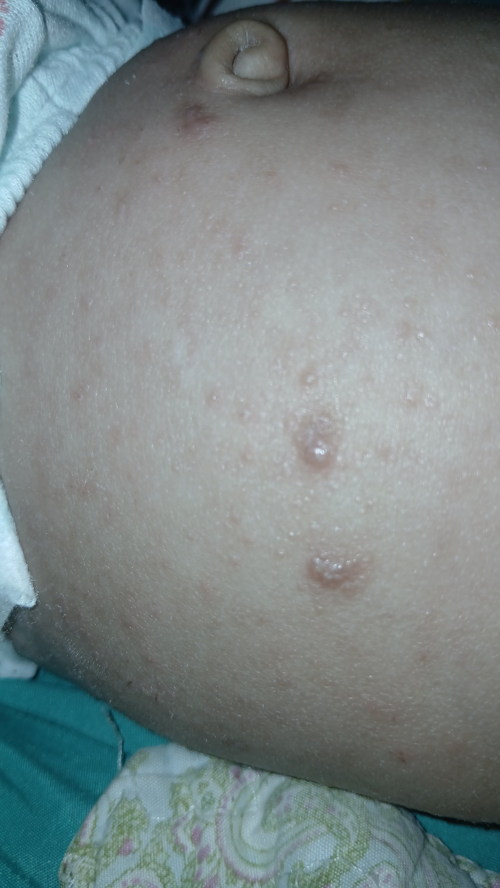 Ayuda para poder comprar una crema y jarabe que necesita mi bebe de 3 meses