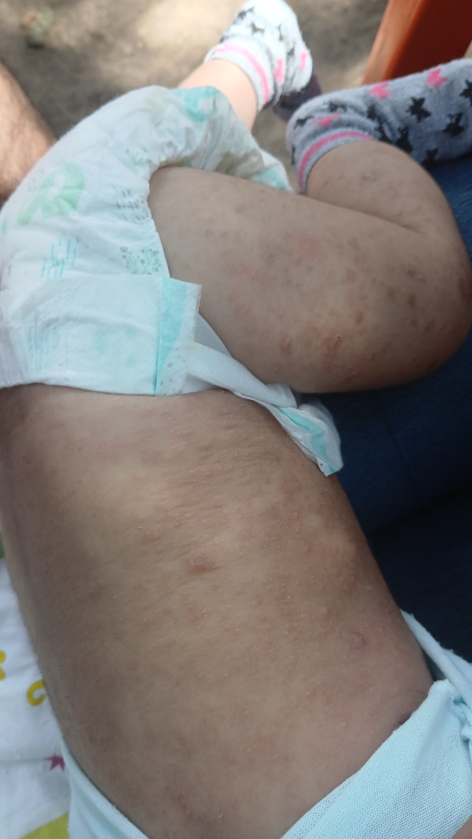 Ayuda para poder comprar una crema y jarabe que necesita mi bebe de 3 meses