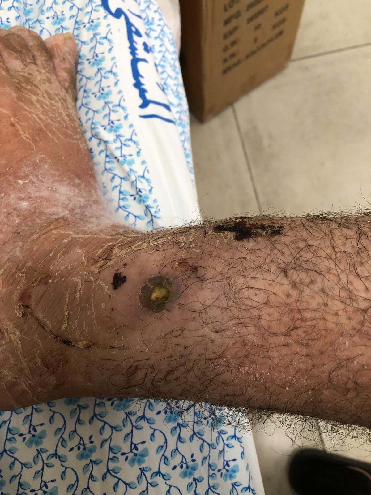 Support Omar's Surgery