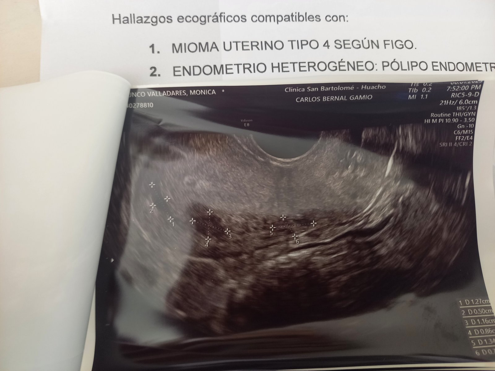 Ayuda para que mi mamá pueda salir de sus deudas y dormir tranquila